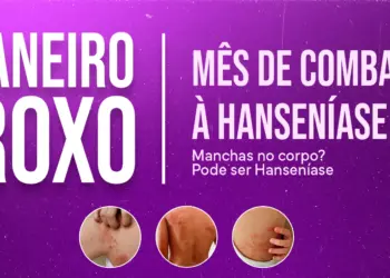 Janeiro Roxo leva ação de conscientização sobre hanseníase ao Cataratas JL Shopping