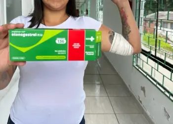 Prefeitura inicia oferta do implante contraceptivo Implanon na rede pública