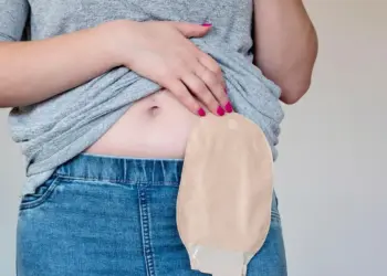 Projeto de lei pretende instituir a Lei Anna Marafon para promover dignidade a pessoas ostomizadas em Foz