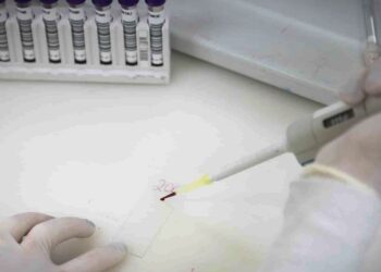 Exames descartam ebola em imigrante da República Democrática do Congo