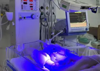 Hospital Regional do Sudoeste amplia assistência neonatal com monitoramento neurológico em tempo real