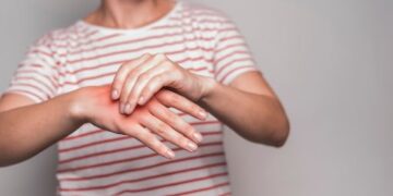 Fibromialgia será tema de audiência pública na Câmara de Foz do Iguaçu